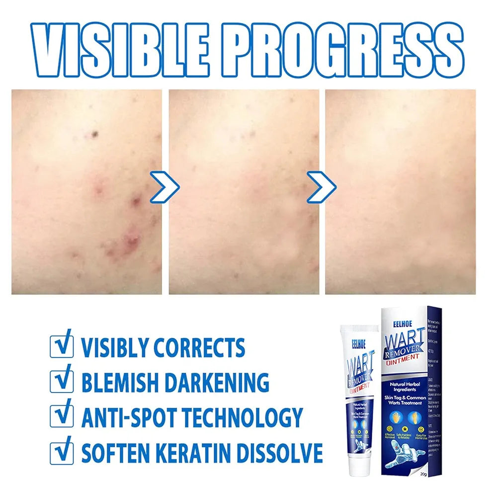 Zavinox™ Herbal Removal Cream