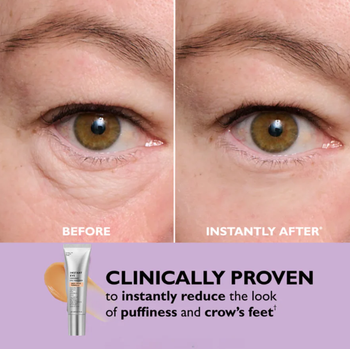 Zavinox Instant Eye-tightener