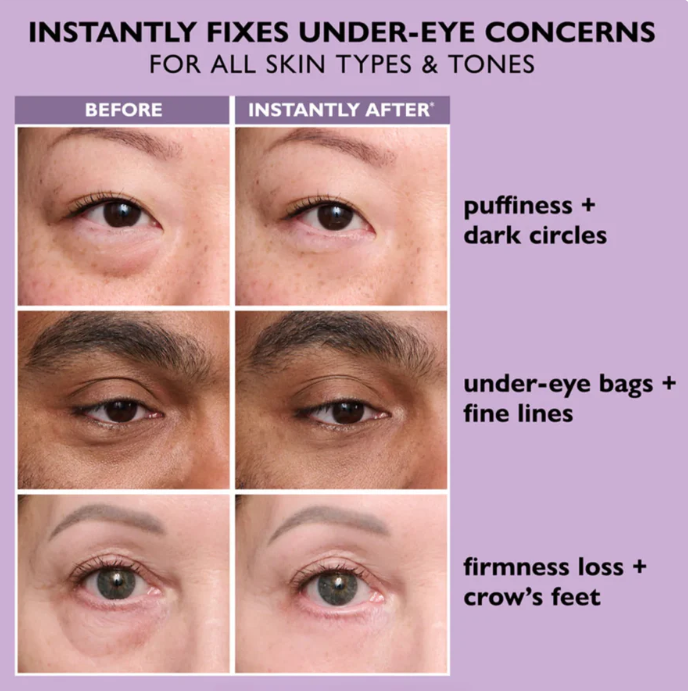 <strong> Instantly Fixes Under-Eye Concerns</strong>