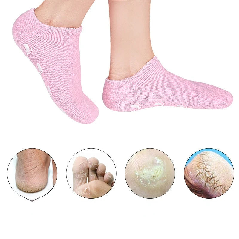 Zavinox™ Exfoliating Gel Socks