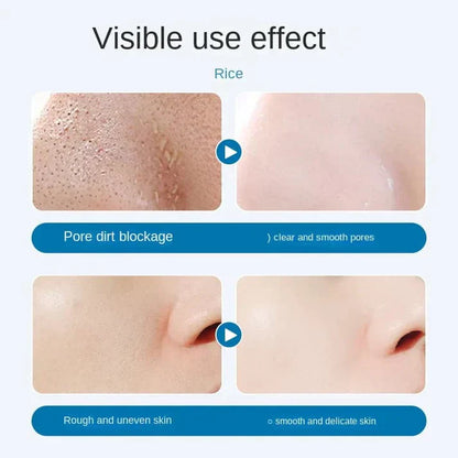 Zavinox™ Oligopeptide Small Bubble Cleansing Essence（10 Pcs）