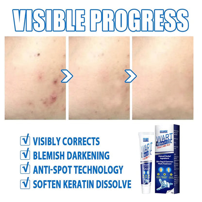 Zavinox™ Herbal Removal Cream