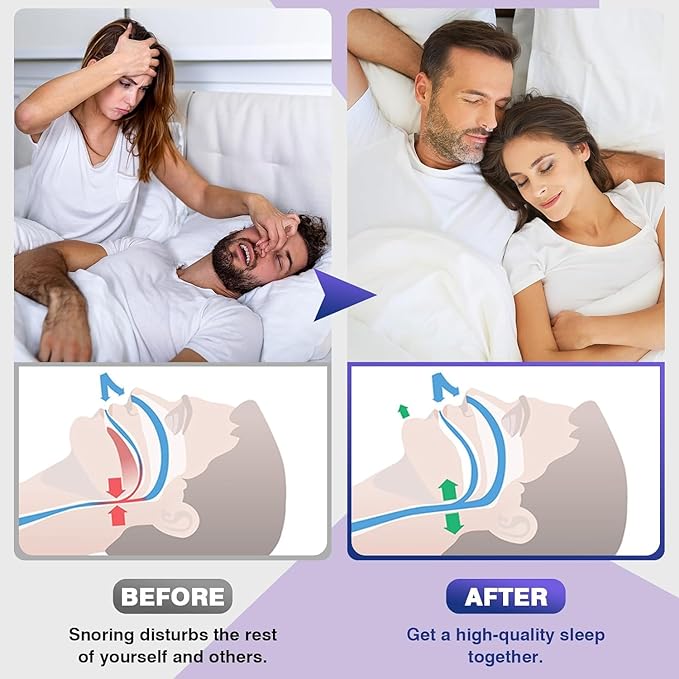 Zavinox™ ANTI SNORING DEVICES