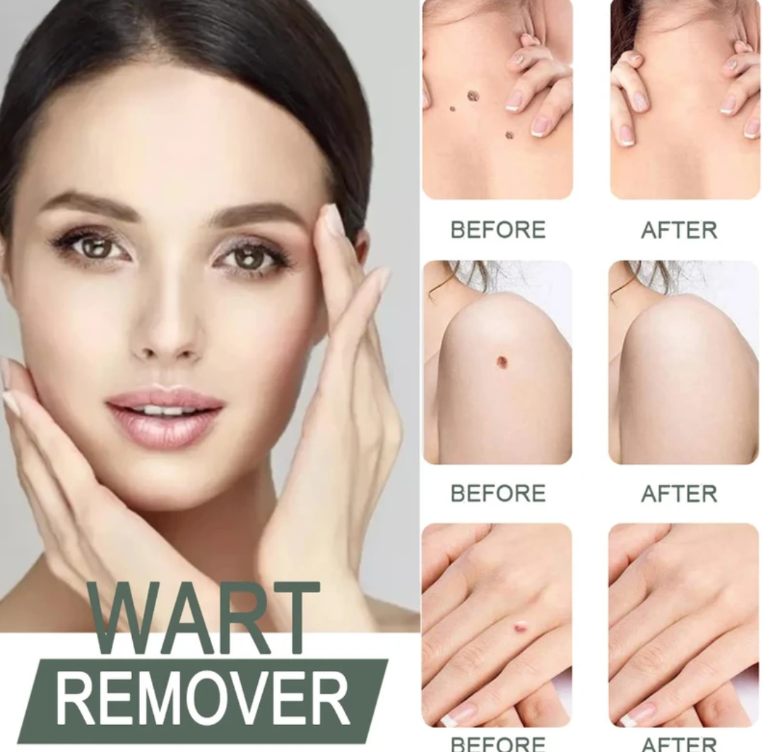 Zavinox™ Herbal Removal Cream