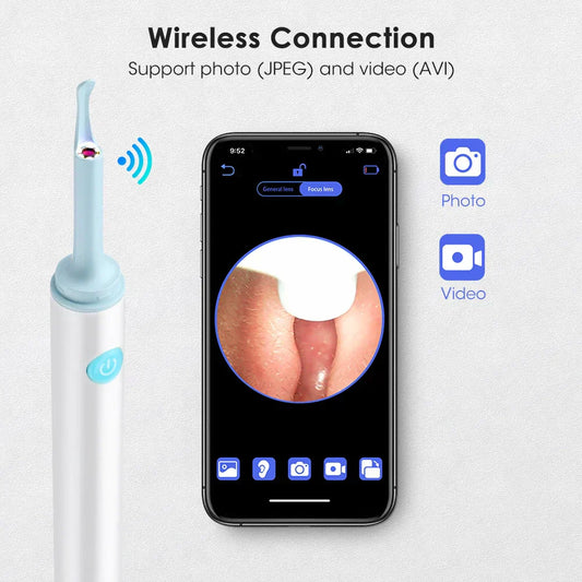 Zavinox™ Loft Ear Wax Remover