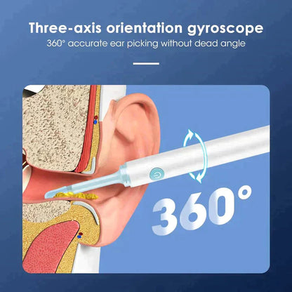 Zavinox™ Loft Ear Wax Remover