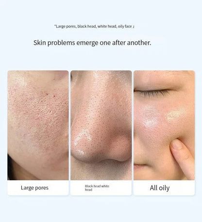 Zavinox™ Oligopeptide Small Bubble Cleansing Essence（10 Pcs）