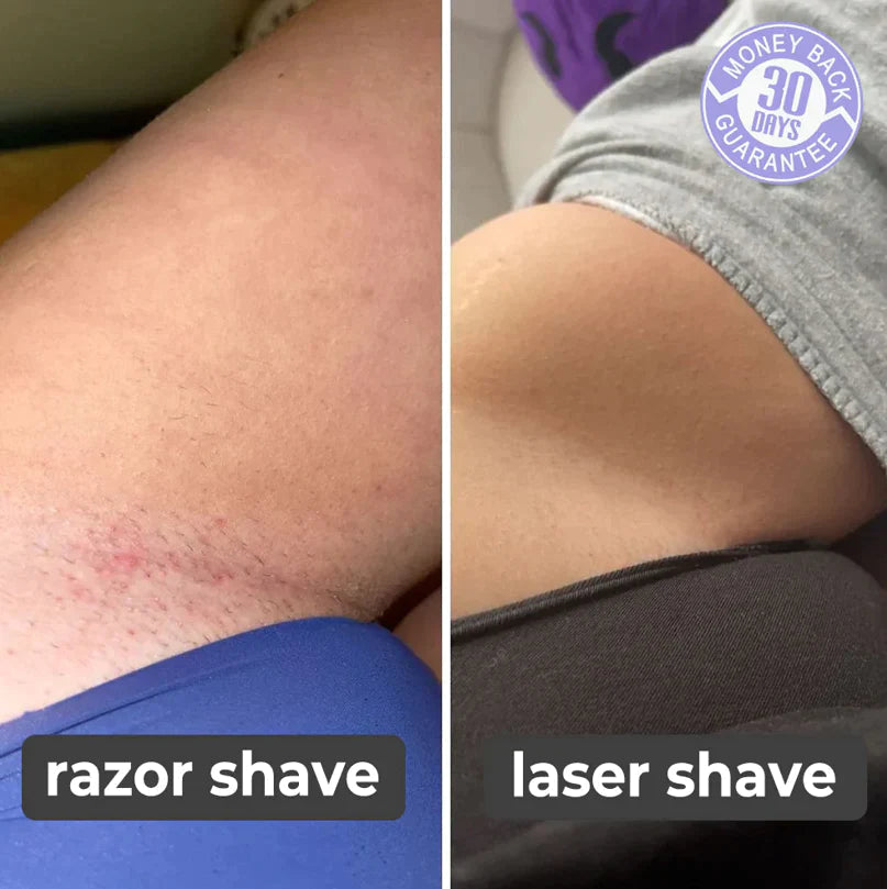 Zavinox™ Laser Hair Remover