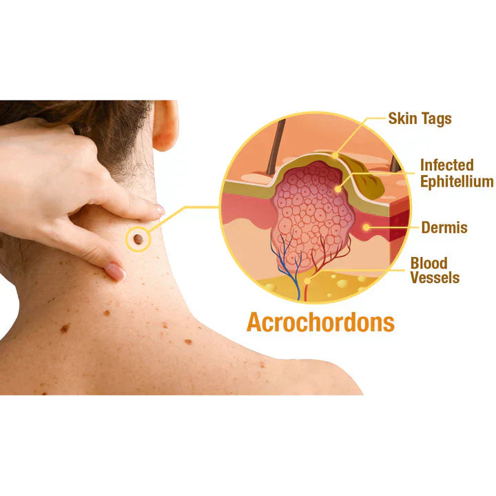 Zavinox™ TagRecede Bee Venom Treatment Spray