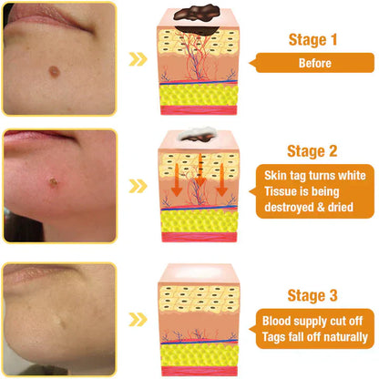 Zavinox™ TagRecede Bee Venom Treatment Spray